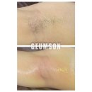 합성동348 | 창원왁싱 창원겨드랑이왁싱 &amp; 창원여자겨드랑이왁싱 잘하는👍 창원슈가링왁싱전문🏅 창원금손언니왁싱🥰