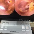 오티콘보청기 신촌센터 해피히어링 이미지