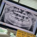 김포리더스치과의원 | 김포 구래동 치과 리더스 치과의원 치료 중 '공황증상'