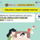 아데노바이러스 증상 눈꼽 감기 요즘 유행하는 감기 이미지