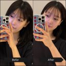 필 | 청담동피부과 라라필 후기 피부결 정리하고 온 솔직관리기록