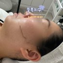미닷 | 울산 북구 양정동 스킨플래닝 잘하는 곳 미닷 스튜디오 후기
