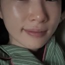 볼륨 | 부산 쥬베룩 볼륨 후기｜결혼 전 팔자 관리, 부산 피부과