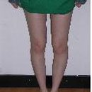 강남세란의원 이미지