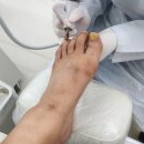 레푸스n바바 | [부산무좀 관리] 레푸스수영점n바바네일 감동 후기