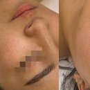 유포리아 에스테틱 이미지