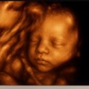 청화약국 | 임신 27주차(ft. 청화병원 입체초음파, 빈혈, 삐콤씨)