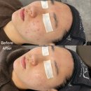 지성정비 | 청주피부관리 트러블 SOS 잠재운 후기!