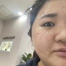 위더스 인셀덤 | 인셀덤 위더스 체험 후기 !
