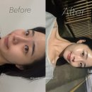 안성 공도 피부관리샵 추천 수기케어 포함된 프리미엄 에스테틱 [오온뷰티]