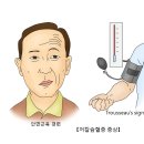 저칼슘혈증[Hypocalcemia] 이미지