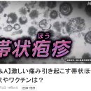 [Q&amp;A] 격심한 통증을 불러일으키는 대상포진 증상이나 왁친은? 이미지