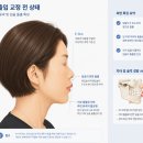 O.K.Line치과의원 | 돌출입교정 40대도 가능할까요? 강남교정치과가 알려드립니다