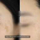 일광수지 이미지