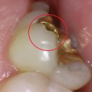 퍼즐치과기공소 이미지