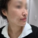 대구 진천동 피부관리 맞춤형 스킨케어 도도한뷰티 후기!