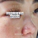 [옥정]꿀피부를 위한 천연 스킨케어 | 양산에스테틱 강추! 모공관리 여드름 잡는 양산피부관리 뷰티센트리 후기