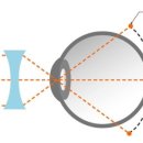 부천연세안과의원 이미지