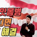 입냄새, 잇몸병 이 두가지면 7일이내 해결 이미지