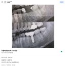미소플란트치과병원 | 달서구 임플란트 잘하는 치과 선택하는 방법에 대해