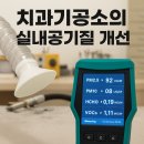 매일기공소 네이버블로그