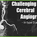 [뇌혈관조영술 한글자막] 매우 어려운 뇌혈관조영술 케이스: 어떻게 하면 Type 3 aortic arch와 같이 어려운 경우를 극복할 이미지