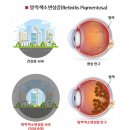 란돌트 아이케어 이미지