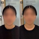 아이제이투어 - 대덕구 장동로 247 | [김해] 트로이아스케 에스테틱 후기