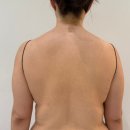 청라피부관리 잘하는 로로에스테틱 등복부관리 강력추천