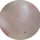 빛이나는피부 이미지