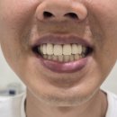 뉴엔치과의원 네이버블로그