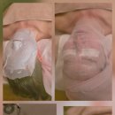 블링S스킨케어 | [블링s스킨케어] 얼굴선이 달라진 느낌이었던 반송동피부관리 후기