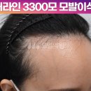 헤어라인 - 고양시 일산동구 | 헤어라인