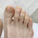 발을/네일엣홈
