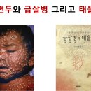 일본서 번지는 괴질, 천연두로 대발하면 급살병 터진다 이미지