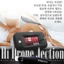 쏘스칼프