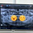 탕정 서울샤치과/샤치과 후기충치·임플란트 서울샤치과 치료하다