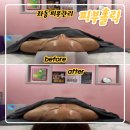 해운대대우1차아파트 | 해운대에스테틱 피부홀릭, 고주파 관리 솔직 후기