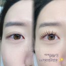 아이요(EYE YO) 이미지