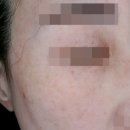 리피부과의원 이미지