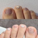 라성로 | 안산 무좀발톱 원곡동 네일샵 네일갤러리 패디 후기