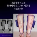 멍박스 | 풀리오 종아리 마사지기 내돈내산 멍 저온화상 흉터 후기 v3 세일