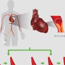 협심증 증상 특징 및 치료 약까지 이미지