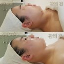 보떼밀양 | 마산 V라인관리