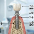 아치치과기공소 이미지