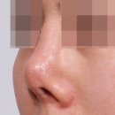 최우식노즈립성형외과의원 이미지