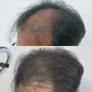 두두뷰티&두피 이미지