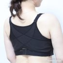 승모근 보톡스 2주 후기, 200유닛 전후 효과