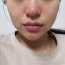 [공지] 더영에스테틱 내돈내산후기