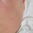 일므이 에스테틱 이미지